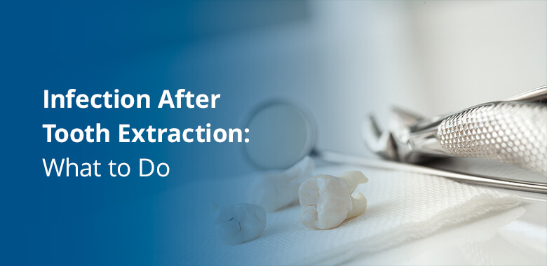 Infection after tooth extraction: what to do. Dentistry tools
